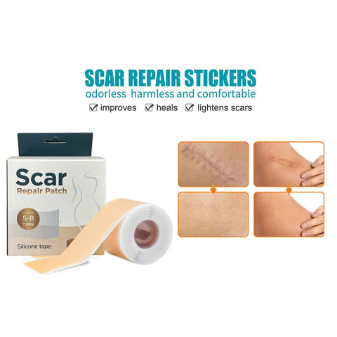 Multi-Purpose Silicone Scar Sheets